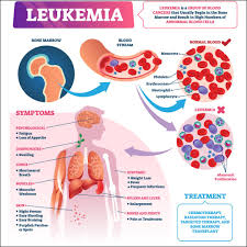 Leukemia and Its Deadly Impact on the Immune System